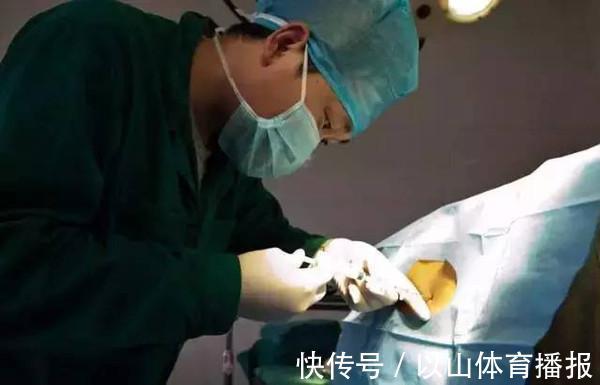 麻药|剖腹产有那么吓人吗?剖腹产步骤和注意事项,提前看看做好准备吧