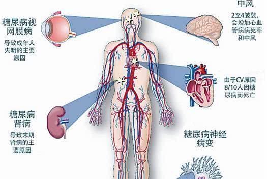 心血管疾病|35岁以上的人，血管越来越堵，1个动作1杯水，让血管干净如初