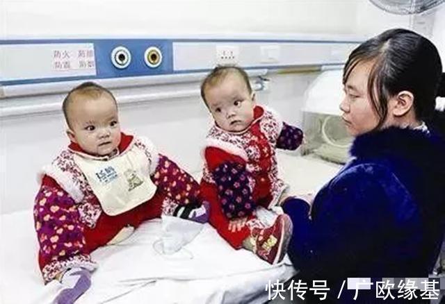 双胞胎|我国首例“坐骨连体”双胞胎,成功分开11年了,她们现在还好吗