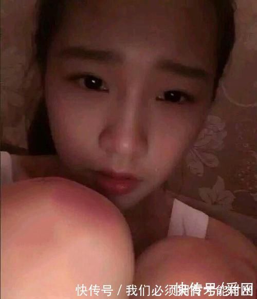 |搞笑p图妹子这膝盖是怎么受伤的,还想要p掉!