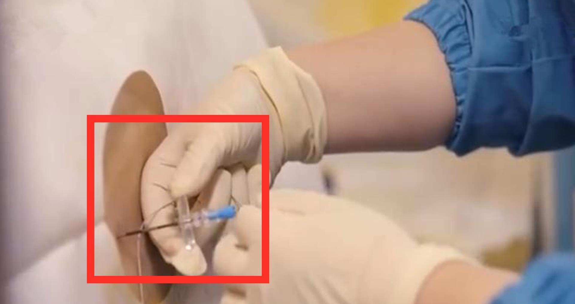 生产|生产痛不欲生,但无痛分娩普及率仅为30%?原因让人无奈