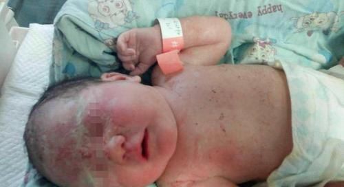 婆婆|产妇破水后不顾婆婆阻拦,赶紧让老公送去医院,医生:直接手术吧