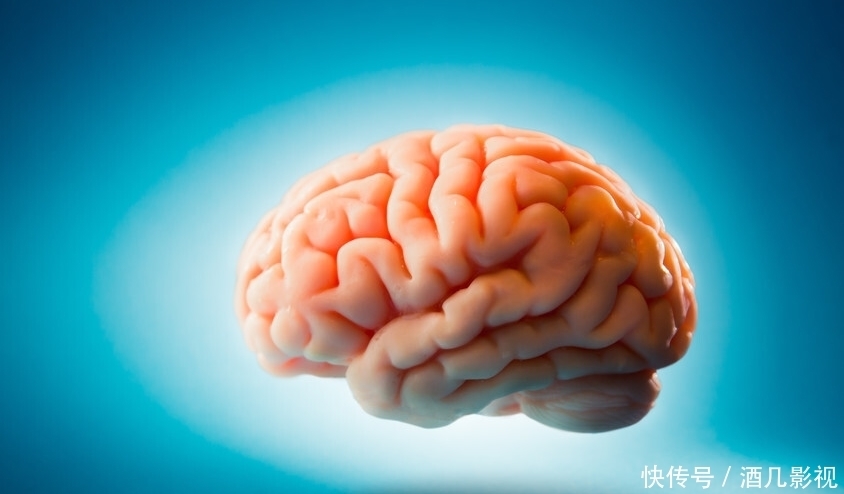 医生提醒:脑梗“源头”被发现,肥肉不是首位的,3物更要当心