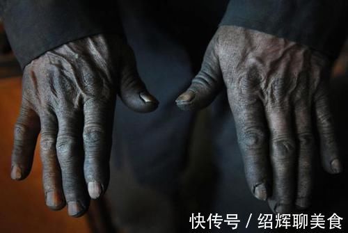 癌症患者|治好的癌症为何又复发了,或许与5点有关,早了解早预防