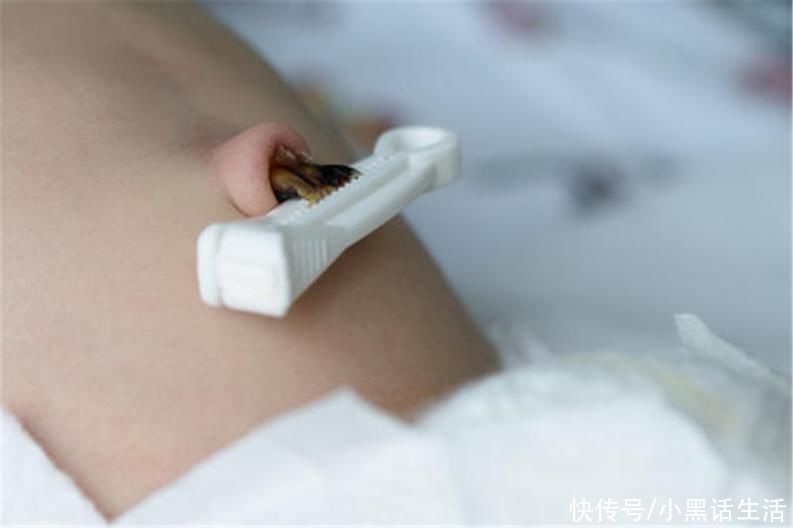 婴儿|婴儿为什么一出生就哭？不哭护士还动手打？千万别心疼宝宝被打