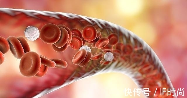 患者|高血压患者有“1麻,1疼,1红”,或许是大脑求救信号