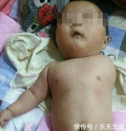 产检|孕妇每次产检都没落下,宝宝出生后全家却嚎啕大哭