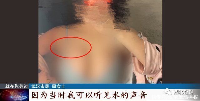 假体|武汉女子隆胸后崩溃:“胸长到肩膀下面了”!医美机构称主刀医生不是医院的