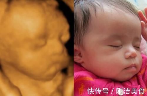 孕妈|孕妈看到胎宝“四维照”,表示娃不像自己,准爸爸:他也不像我!