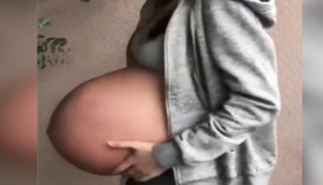 悬垂肚|孕妈因“悬垂肚”走红,人人都说是双胞胎,宝妈的讲述让人心疼