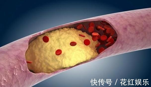 血液流变学|高血脂人群,牢记:常吃1物,稳定血脂清理血管,赶走健康隐患!