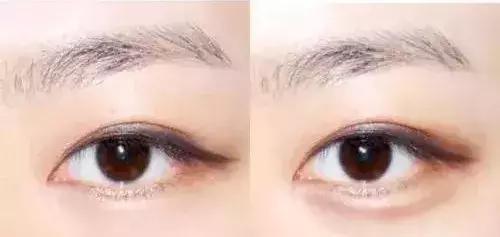 眼窝|眼睛有3个特点的女生,拍照不好看还显凶,没有灵气