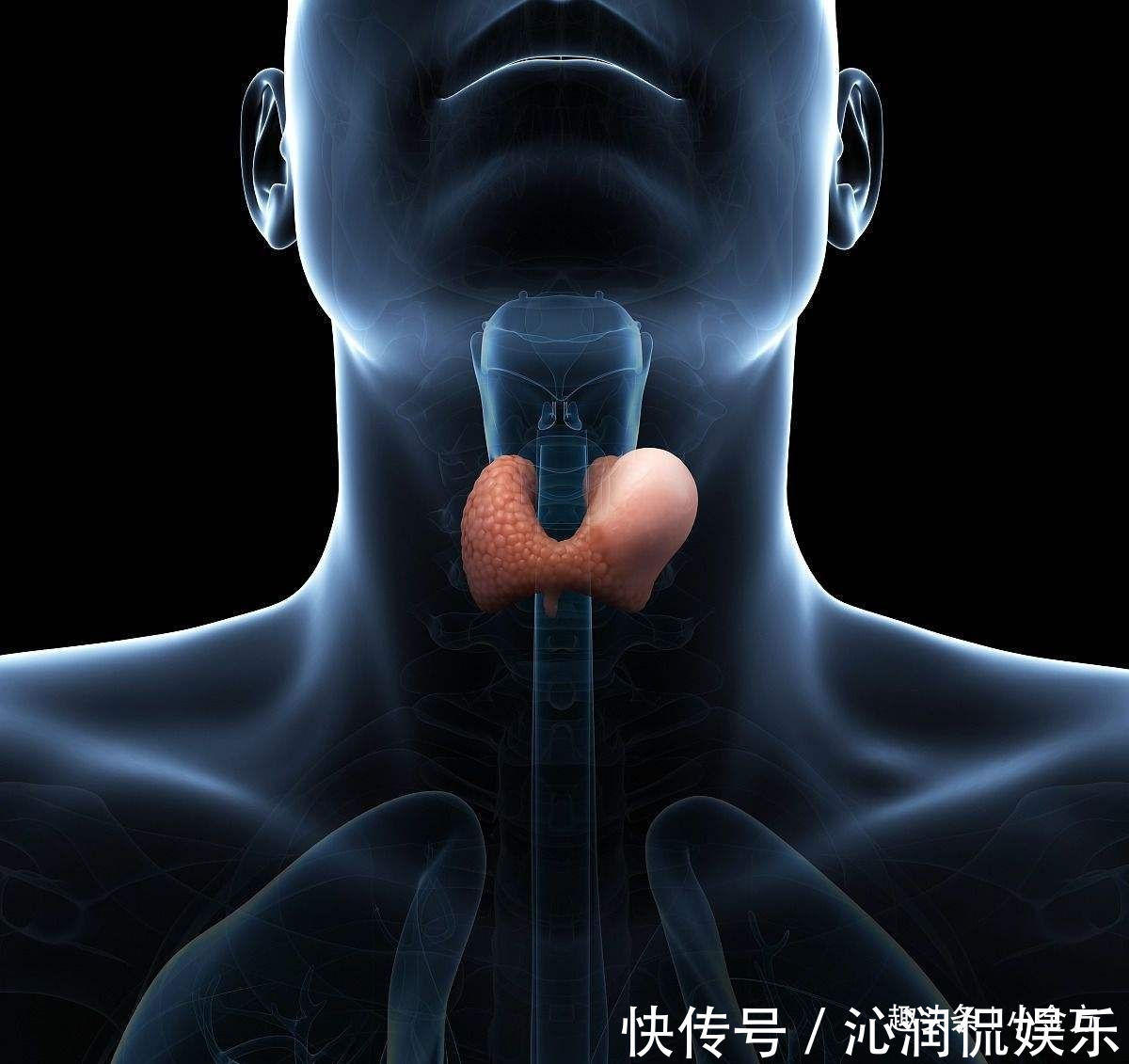 甲状腺|神奇!喝了半个月的海带汤,甲状腺结节没了,还有一个中成药根治