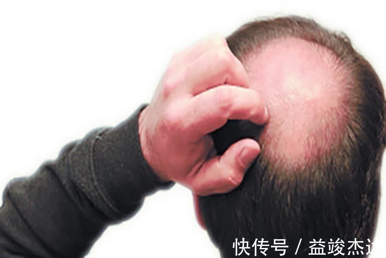 传男不传女|爸爸这些“毁形象”特征,基本“传男不传女”,第一个就很难接受