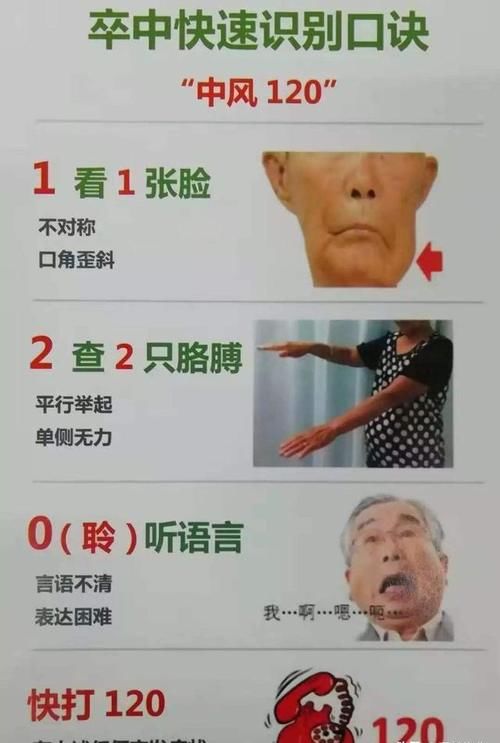  早期|脑梗死、脑出血什么时候最容易发生？早期如何来防范、识别呢？