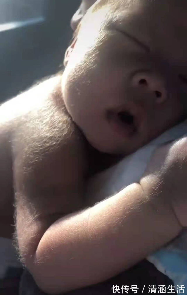 绒毛|宝妈吐槽自己生了一颗“猕猴桃”,晒出宝宝照片后,网友恍然大悟
