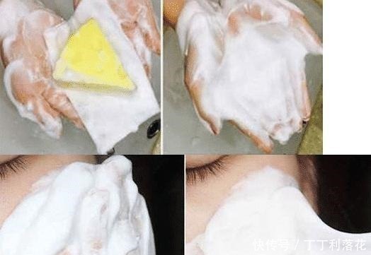 嘴角的下巴总是有白色的痘痘,且还连成一片,是螨虫吗