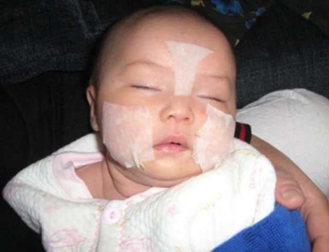 宝宝|宝宝患有特应性皮炎,家长日常如何防护?