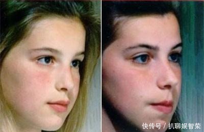 孩子|用嘴呼吸会变丑?父母看到宝宝用嘴呼吸要即使制止!