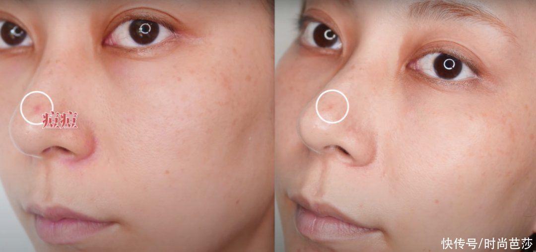 那些脸上没瑕疵的人，都在“酸”些什么？