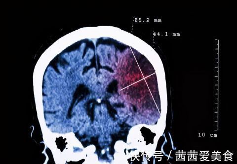 心肌梗死|每天这个时段血压最易超标！5种措施来降压