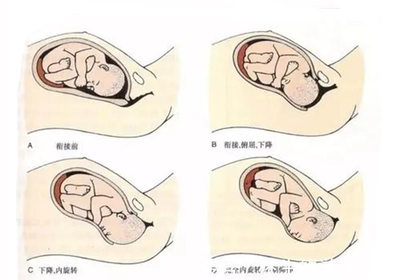 胎儿|产妇顺产已经能看见小孩子头了,医生一直等,这符合操作规程吗?