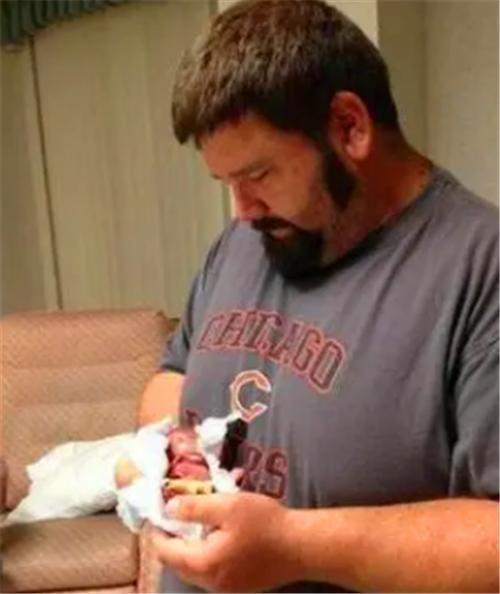 利物浦大学|18年了,那个出生仅280克,曾打破世界纪录的女婴,如今已认不出