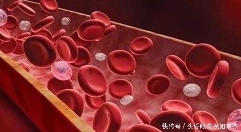 心脑血管疾病|血栓天敌被发现了,每天吃2口,清血管冲走血栓,杜绝高血脂