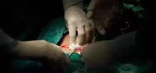 产妇|顺产先苦后甜,剖腹产先甜后苦,而选择剖腹产的孕妈,这8种痛逃不掉