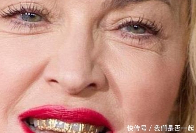 钻石|土豪的世界我们果然不懂,牙齿上面镶钻,你能接受吗?