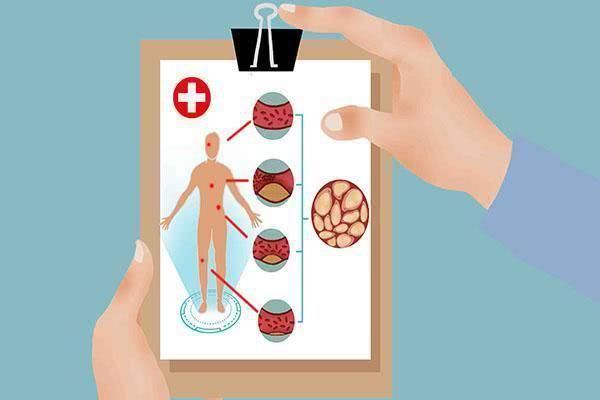 高手|天然溶栓高手现身,不是洋葱木耳,坚持吃点,血管通畅远离血栓