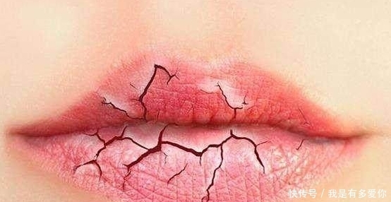 要是不爱护嘴唇,干裂的话!就算把一条河里的水喝光也没用!