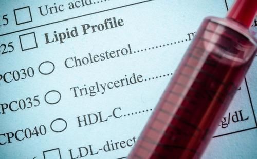 甘油三酯|降甘油三酯“高手”被公布了,平时可劲喝,血脂或可降下来