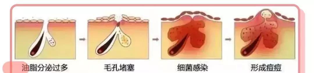你的护肤方式上黑名单了吗辟谣10个火爆全网的烂脸护肤伪科学