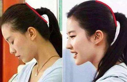 真香|“黑脸宝宝”出生后被嫌弃,2月后却逆袭成“团宠”,宝爸:真香