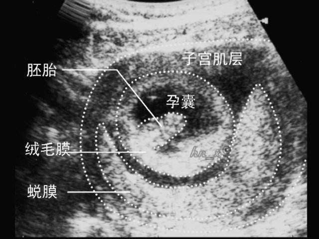 精子和卵子|排卵期同房后，多久可以怀上宝宝？怀孕过程及孕早期注意提前了解