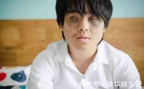 降压药|高血压患者怕缺钾?心脑血管专家:几大补钾清单已列出,平时吃