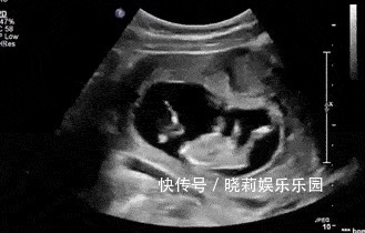 定时数|为什么胎儿总在晚上踢妈妈?主要原因有3个,你要学会分辨