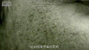 一戴瘦脸5cm，拍照都不用p图的防晒神器，还不入手？