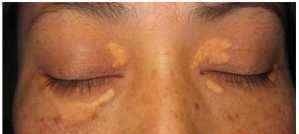 高血脂|这一种粗粮是公认的“降脂冠军”,血脂高的人经常吃,血管通透