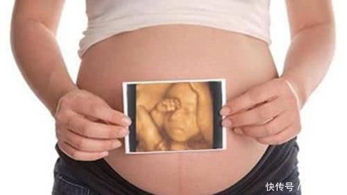 肚皮|孕妇做B超,为什么医生要涂一层黏乎乎的胶体,说出来你可能不信