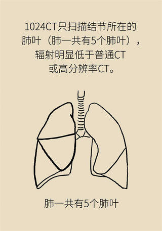 治疗|如何尽早确定肺结节治疗方案？1024靶扫描了解一下