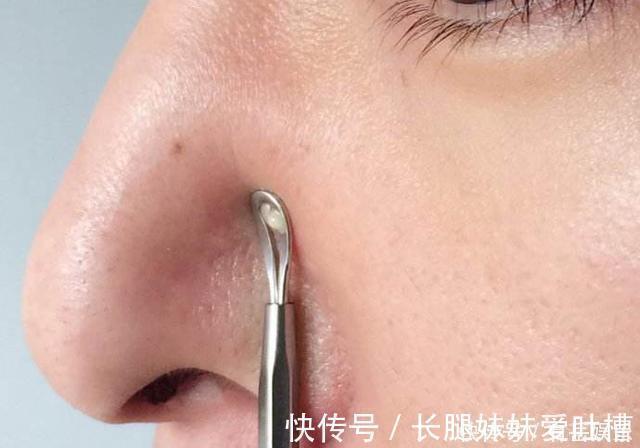 肝脏|“肝毒”太深，“脸上”有3种表现，排除肝毒，按一穴、吃三蔬