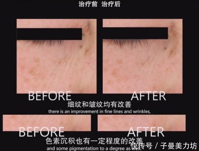 拒绝皱纹,想抗老?护肤品成分中的黄金搭档,会是你的指路明灯!