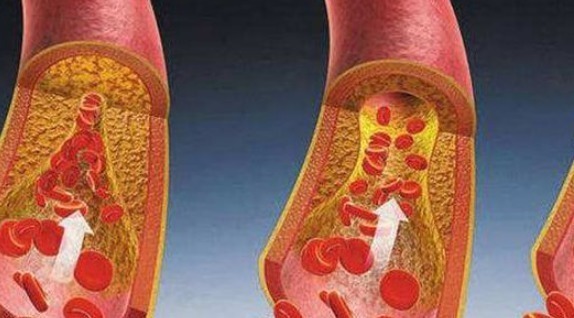 睡眠质量|男性雄性激素旺盛，身上会有3特征，只要占2个，恭喜男人味十足