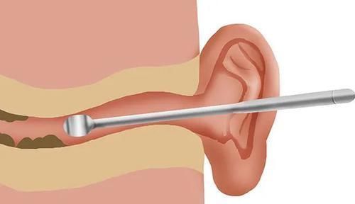 为什么有人是油耳朵,有人是干耳朵?有哪些区别?