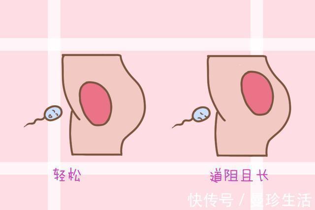 小美|女性子宫位置,决定了怀孕的难易程度,若有这些情况,是难孕体质