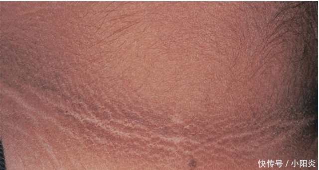 医院|9岁小女孩脖颈发黑洗不掉,经医院检查后,医生的话却让家长笑了