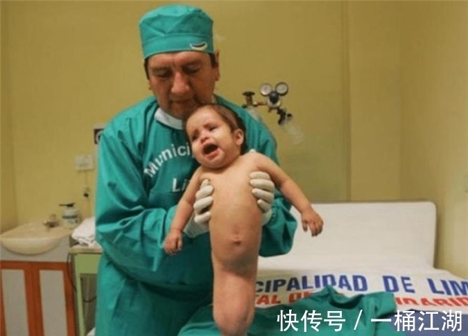 双腿|美国女孩出生患美人鱼症,喜欢在水里,生存十年创造医学奇迹