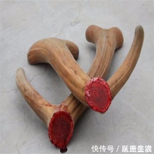 养肾|男性健康要先从养肾开始,这几个养肾的小妙招一定要收藏!